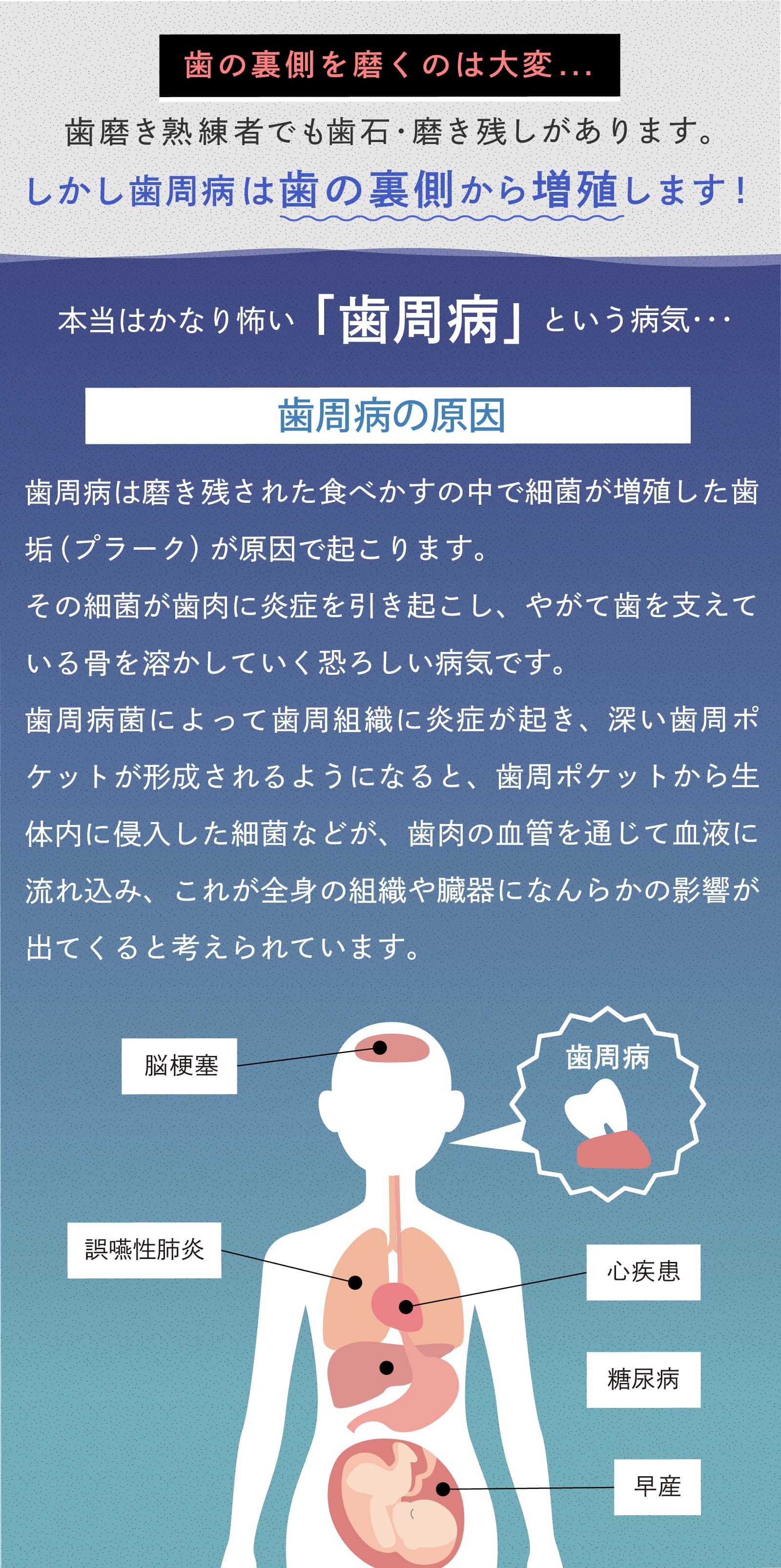 歯周病という病気